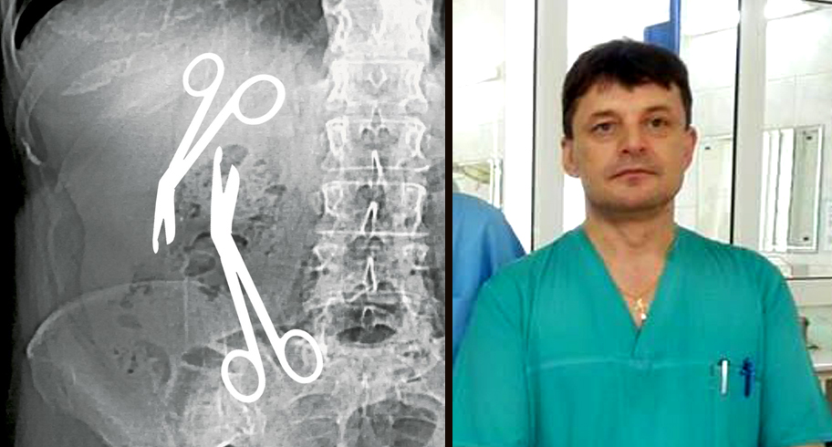 Investigație Libertatea: Directorul medical al Spitalului Militar din Constanța a uitat două foarfeci de 16 cm în burta unei paciente