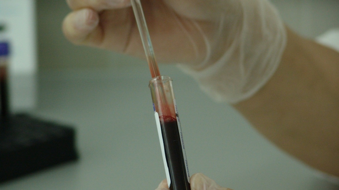 Tot personalul medical și non-medical din unitățile sanitare din Constanța va fi testat pentru depistarea noului coronavirus, cu ajutorul Grup Servicii Petroliere